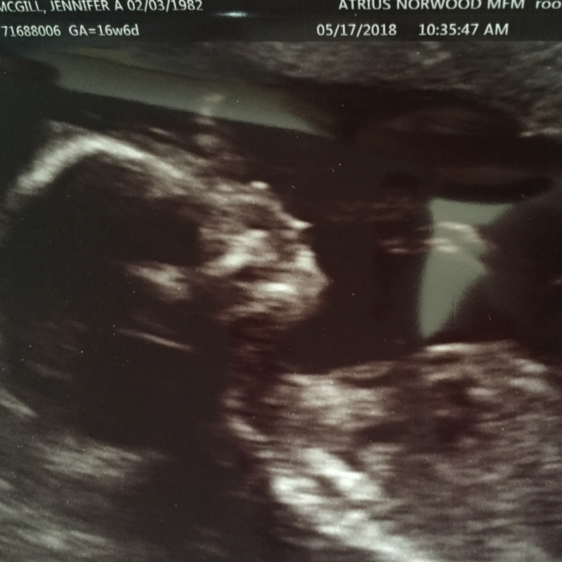 /images/pfpPhotos/DM0465_McBaby_55497_crop.jpg